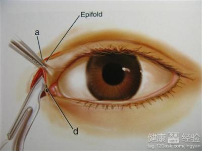 開眼角的作用